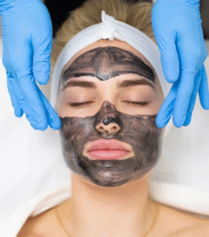 Carbon PhotoFacial Laser Treatment