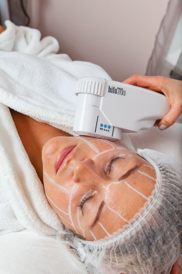 YAG Laser PhotoFacial